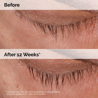 Multi-Peptide Lash and Brow Serum
